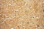 DISC1-long Antibody in Immunohistochemistry (Paraffin) (IHC (P))