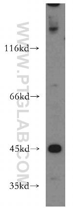 KISS1R Antibody in Western Blot (WB)