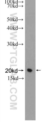 Transgelin-2 Antibody in Western Blot (WB)