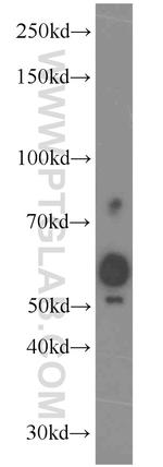SPO11 Antibody in Western Blot (WB)