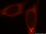 SMU1 Antibody in Immunocytochemistry (ICC/IF)