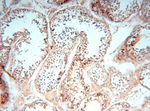 SMU1 Antibody in Immunohistochemistry (Paraffin) (IHC (P))