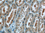 SMU1 Antibody in Immunohistochemistry (Paraffin) (IHC (P))