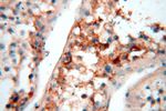 SMU1 Antibody in Immunohistochemistry (Paraffin) (IHC (P))