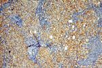 SMU1 Antibody in Immunohistochemistry (Paraffin) (IHC (P))