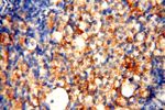 SMU1 Antibody in Immunohistochemistry (Paraffin) (IHC (P))
