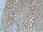 SMU1 Antibody in Immunohistochemistry (Paraffin) (IHC (P))