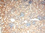 SMU1 Antibody in Immunohistochemistry (Paraffin) (IHC (P))