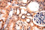 SMU1 Antibody in Immunohistochemistry (Paraffin) (IHC (P))