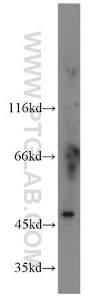 SMU1 Antibody in Western Blot (WB)