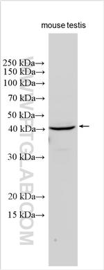 HSD3B2 Antibody in Western Blot (WB)