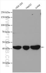 GMPPA Antibody in Western Blot (WB)