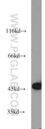 GMPPA Antibody in Western Blot (WB)