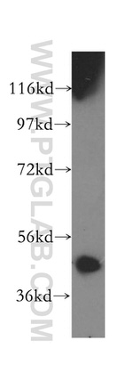GMPPA Antibody in Western Blot (WB)