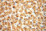 HACL1 Antibody in Immunohistochemistry (Paraffin) (IHC (P))