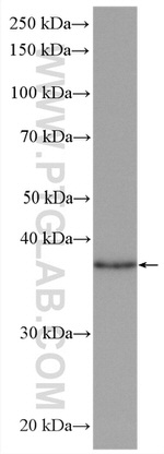 KCTD12 Antibody in Western Blot (WB)