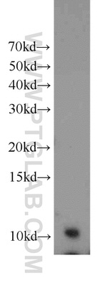 SF3B5 Antibody in Western Blot (WB)