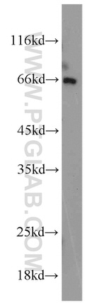 PAFAH Antibody in Western Blot (WB)
