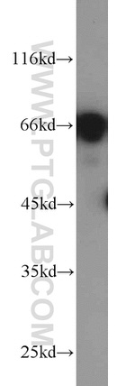 PAFAH Antibody in Western Blot (WB)