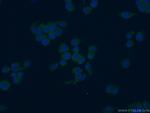 PAFAH Antibody in Immunocytochemistry (ICC/IF)