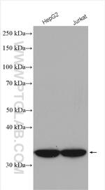 MTX1 Antibody in Western Blot (WB)