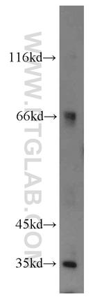 MTX1 Antibody in Western Blot (WB)