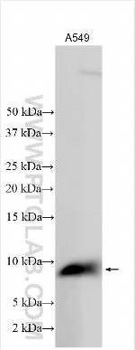 DHRS7B Antibody in Western Blot (WB)