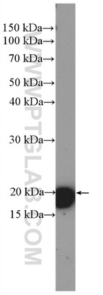 HRAS Antibody in Western Blot (WB)