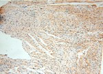 PPM1G Antibody in Immunohistochemistry (Paraffin) (IHC (P))