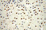 PPM1G Antibody in Immunohistochemistry (Paraffin) (IHC (P))