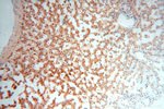 PPM1G Antibody in Immunohistochemistry (Paraffin) (IHC (P))