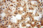 PPM1G Antibody in Immunohistochemistry (Paraffin) (IHC (P))