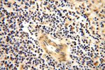 PPM1G Antibody in Immunohistochemistry (Paraffin) (IHC (P))