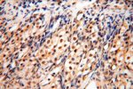 PPM1G Antibody in Immunohistochemistry (Paraffin) (IHC (P))