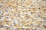 PPM1G Antibody in Immunohistochemistry (Paraffin) (IHC (P))