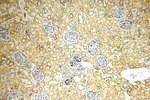 PPM1G Antibody in Immunohistochemistry (Paraffin) (IHC (P))