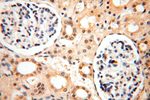 PPM1G Antibody in Immunohistochemistry (Paraffin) (IHC (P))