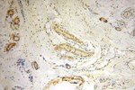 PPM1G Antibody in Immunohistochemistry (Paraffin) (IHC (P))