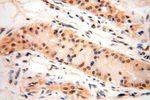 PPM1G Antibody in Immunohistochemistry (Paraffin) (IHC (P))