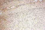 PPM1G Antibody in Immunohistochemistry (Paraffin) (IHC (P))