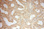 PPM1G Antibody in Immunohistochemistry (Paraffin) (IHC (P))