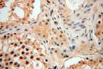 PPM1G Antibody in Immunohistochemistry (Paraffin) (IHC (P))