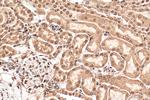 PPM1G Antibody in Immunohistochemistry (Paraffin) (IHC (P))