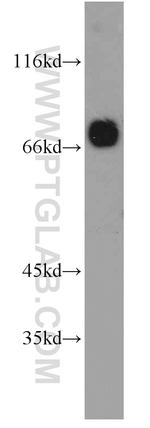 PPM1G Antibody in Western Blot (WB)