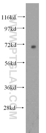 PPM1G Antibody in Western Blot (WB)