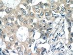 RPL36AL Antibody in Immunohistochemistry (Paraffin) (IHC (P))
