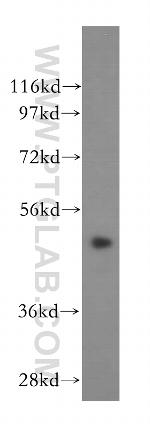 CSTF1 Antibody in Western Blot (WB)
