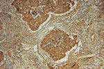 NTF2 Antibody in Immunohistochemistry (Paraffin) (IHC (P))