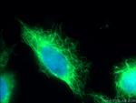 Cytokeratin 7 Antibody in Immunocytochemistry (ICC/IF)