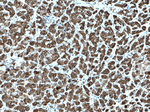 Cytokeratin 7 Antibody in Immunohistochemistry (Paraffin) (IHC (P))